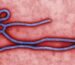 ebola